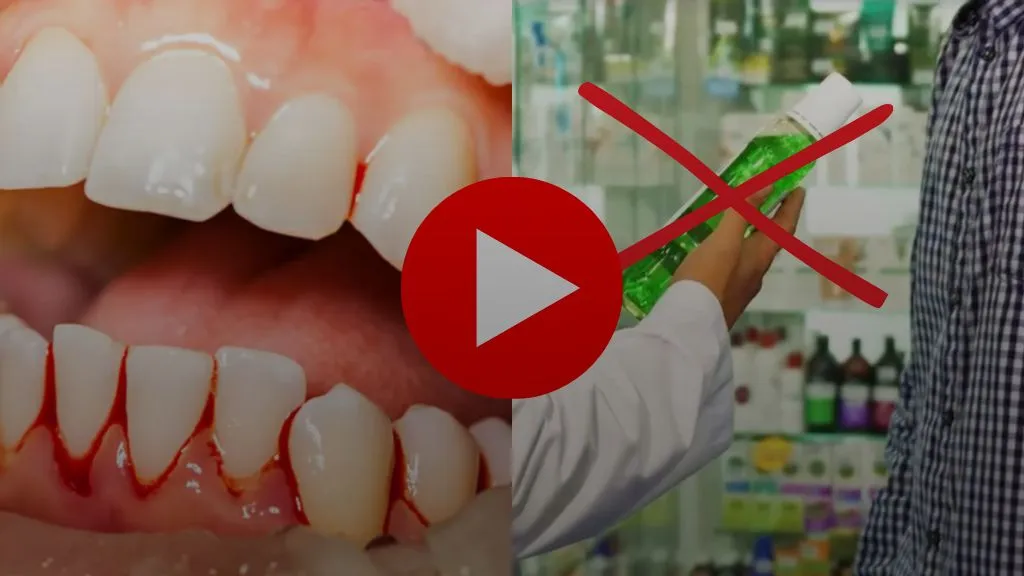 Bleeding gums when brushing